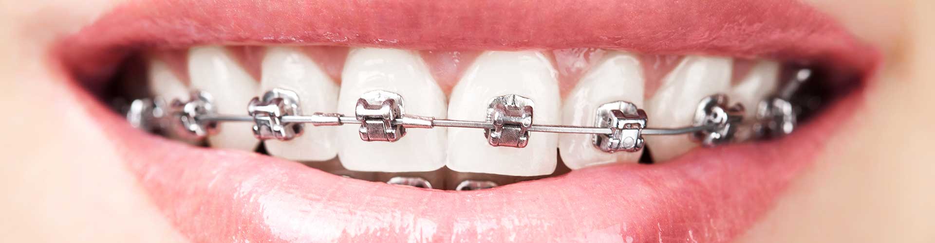 Orthodontics | Tooth Suite Family Dentistry | General Dentist | Lloydminster