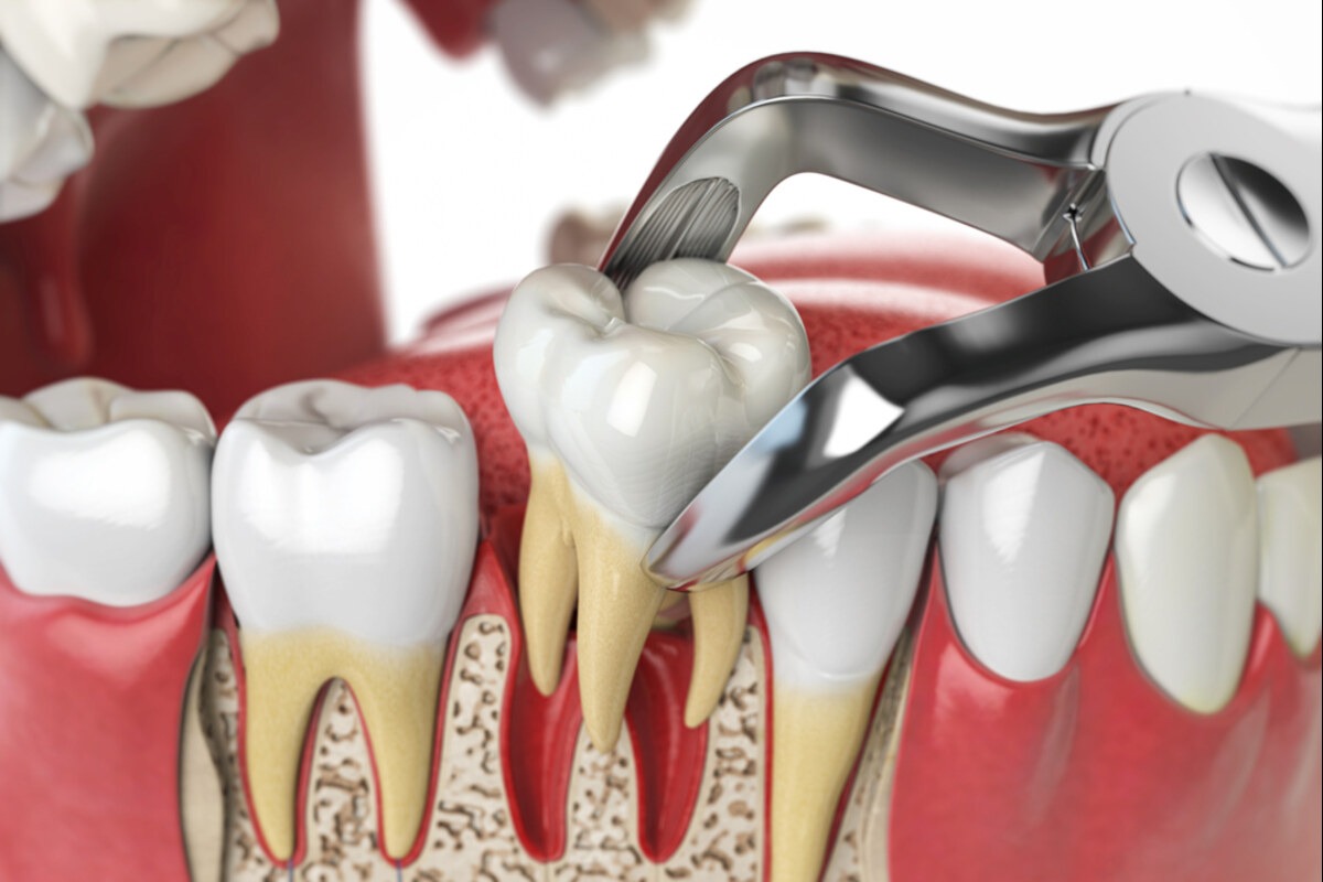 oral surgery in lloydminster