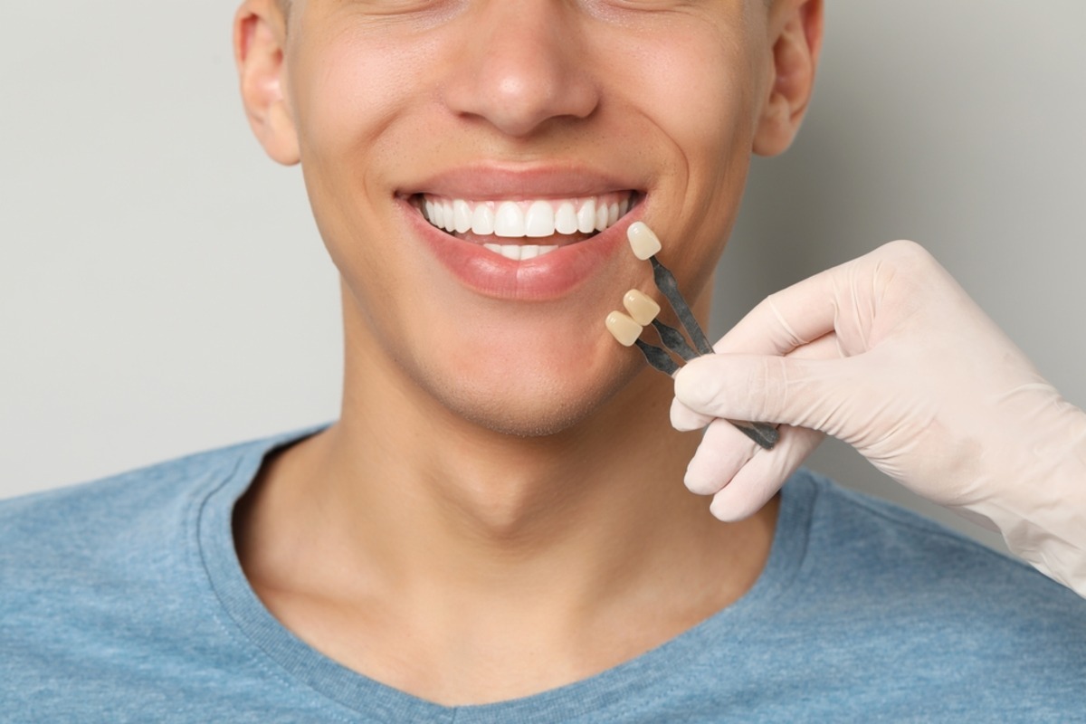 porcelain veneers in lloydminster